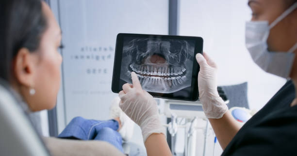 Licensed Tooth Extraction service in Brighton, MI - Smile Center Dentistry